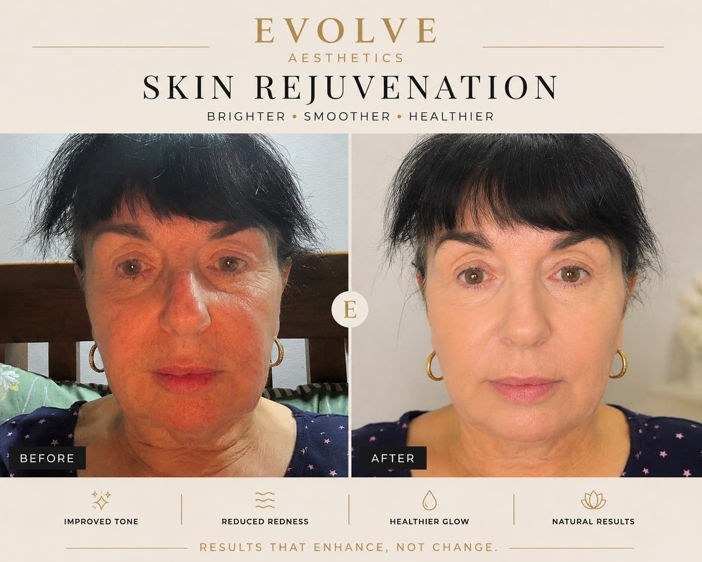 Before and after treatment photograph