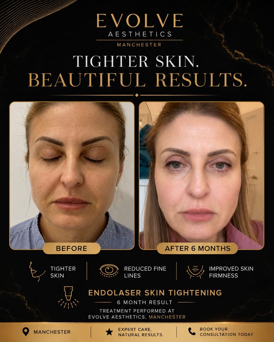 Before and after treatment photograph, gallery image two