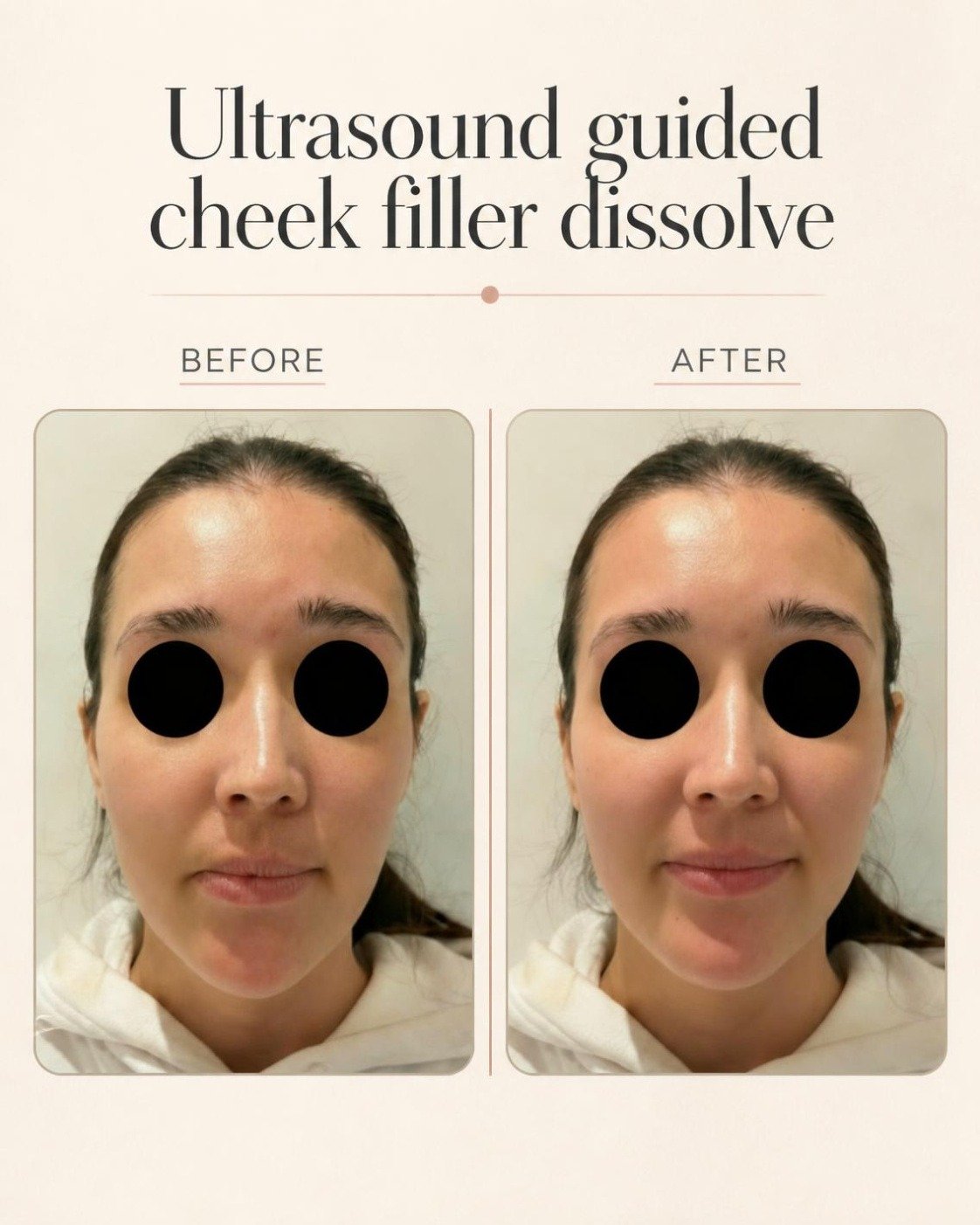 Before and after treatment photograph, gallery image three