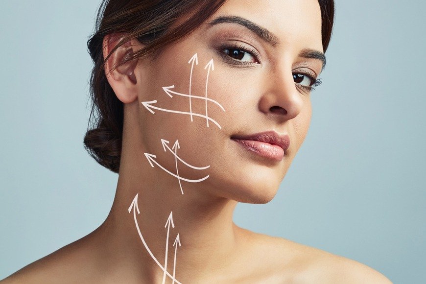 Profhilo treatment